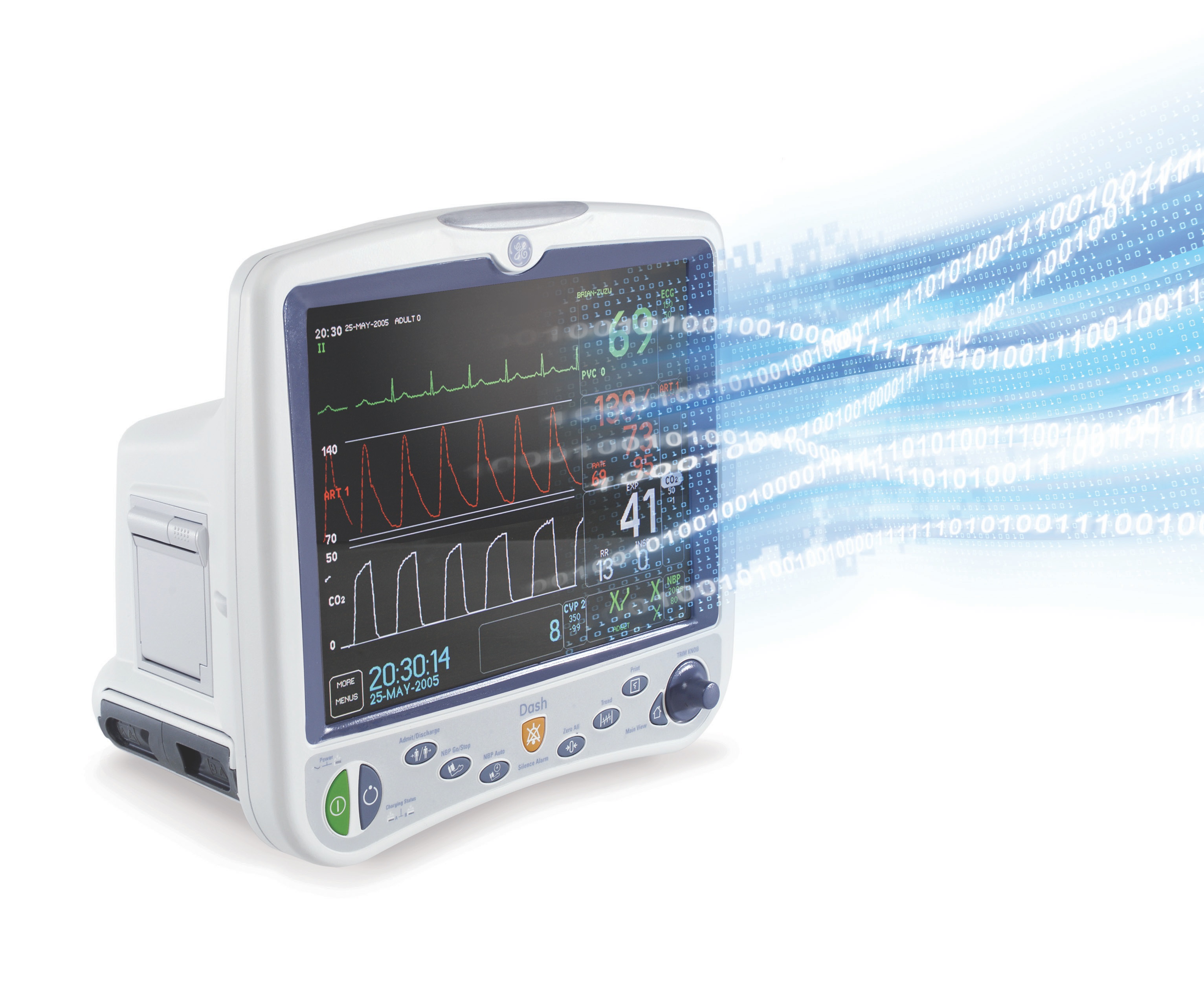 Vital sign monitor displaying patient readings